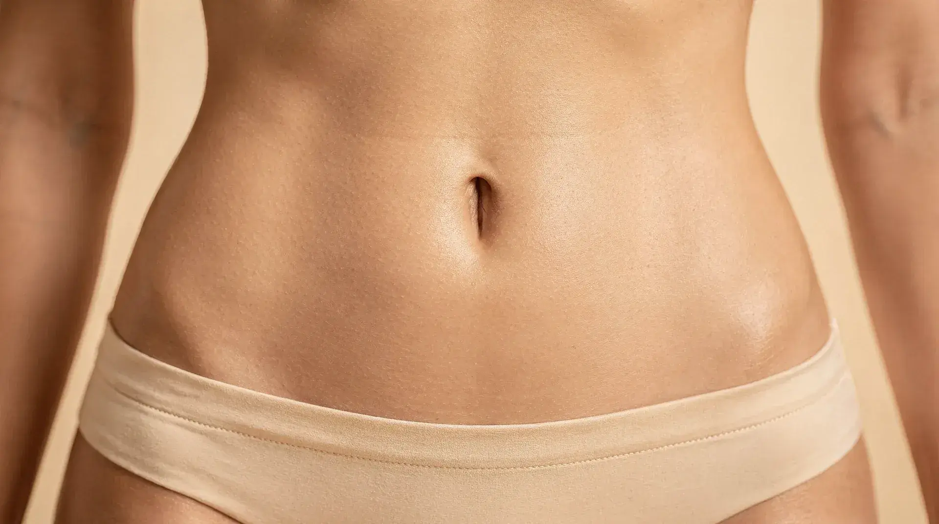 Umbilicoplasty result